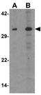 Cyclin Dependent Kinase Inhibitor 1C antibody, GTX31859, GeneTex, Western Blot image 