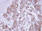 FAS antibody, LS-C186153, Lifespan Biosciences, Immunohistochemistry paraffin image 