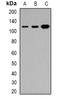 Tensin 3 antibody, orb382465, Biorbyt, Western Blot image 