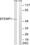 EGF Containing Fibulin Extracellular Matrix Protein 1 antibody, LS-C119946, Lifespan Biosciences, Western Blot image 