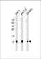 S100 Calcium Binding Protein A2 antibody, M03698, Boster Biological Technology, Western Blot image 