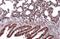 Cyclin Dependent Kinase 12 antibody, GTX130809, GeneTex, Immunohistochemistry paraffin image 