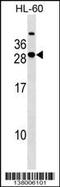 Syntaxin Binding Protein 6 antibody, 59-528, ProSci, Western Blot image 