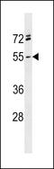 Repulsive Guidance Molecule BMP Co-Receptor A antibody, LS-C158842, Lifespan Biosciences, Western Blot image 