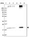 Transmembrane Protein 205 antibody, NBP1-81255, Novus Biologicals, Western Blot image 