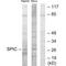 Spi-C Transcription Factor antibody, A13433, Boster Biological Technology, Western Blot image 
