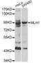 MutL Homolog 1 antibody, STJ24563, St John