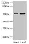 Keratin 80 antibody, CSB-PA760849LA01HU, Cusabio, Western Blot image 