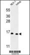 Small Nuclear Ribonucleoprotein D3 Polypeptide antibody, 63-872, ProSci, Western Blot image 