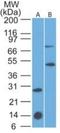 Interleukin 7 Receptor antibody, NBP2-25249, Novus Biologicals, Western Blot image 