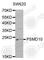 Proteasome 26S Subunit, Non-ATPase 10 antibody, A1949, ABclonal Technology, Western Blot image 