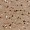 Histone Deacetylase 2 antibody, NBP1-87109, Novus Biologicals, Immunohistochemistry frozen image 