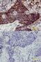 Erb-B2 Receptor Tyrosine Kinase 3 antibody, MAB3483, R&D Systems, Immunohistochemistry frozen image 