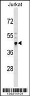 Cysteine-rich with EGF-like domain protein 2 antibody, 60-242, ProSci, Western Blot image 