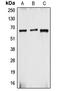 Cytochrome B-245 Beta Chain antibody, LS-C352078, Lifespan Biosciences, Western Blot image 