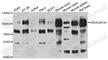 Rho GTPase Activating Protein 26 antibody, A8195, ABclonal Technology, Western Blot image 