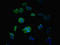 Matrilin-3 antibody, LS-C376094, Lifespan Biosciences, Immunofluorescence image 