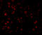 Interleukin 1 Receptor Associated Kinase 4 antibody, A01247-1, Boster Biological Technology, Immunofluorescence image 