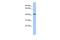 Olfactomedin Like 1 antibody, GTX45172, GeneTex, Western Blot image 