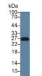 Linker For Activation Of T Cells antibody, LS-C314452, Lifespan Biosciences, Western Blot image 