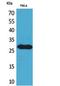 Small nuclear ribonucleoprotein-associated protein N antibody, STJ96822, St John