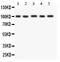 Fibroblast Growth Factor Receptor 4 antibody, PB9193, Boster Biological Technology, Western Blot image 