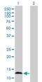 Nuclear Factor Of Activated T Cells 2 Interacting Protein antibody, H00084901-B01P, Novus Biologicals, Western Blot image 