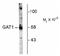 Solute Carrier Family 6 Member 1 antibody, NB100-61097, Novus Biologicals, Western Blot image 