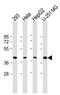 GIPC PDZ Domain Containing Family Member 1 antibody, MBS9208255, MyBioSource, Western Blot image 