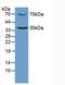 MPL Proto-Oncogene, Thrombopoietin Receptor antibody, LS-C295474, Lifespan Biosciences, Western Blot image 