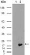 Baculoviral IAP Repeat Containing 5 antibody, GTX83094, GeneTex, Western Blot image 