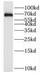 Kinesin Family Member 12 antibody, FNab04550, FineTest, Western Blot image 