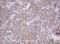 Mitochondrial Translational Initiation Factor 3 antibody, M11221-1, Boster Biological Technology, Immunohistochemistry paraffin image 