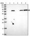 Kelch Repeat And BTB Domain Containing 6 antibody, PA5-61836, Invitrogen Antibodies, Western Blot image 