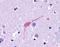 Dopamine receptor D1 antibody, NLS43, Novus Biologicals, Immunohistochemistry frozen image 