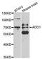 SRBP1 antibody, A1592, ABclonal Technology, Western Blot image 