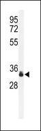 Sprouty RTK Signaling Antagonist 4 antibody, LS-C161477, Lifespan Biosciences, Western Blot image 