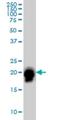 Ras Homolog Family Member A antibody, H00000387-M03, Novus Biologicals, Western Blot image 