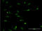 Argininosuccinate Synthase 1 antibody, LS-C196704, Lifespan Biosciences, Immunofluorescence image 