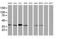 MAGE Family Member B1 antibody, MA5-26451, Invitrogen Antibodies, Western Blot image 