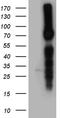 Sodium Channel Epithelial 1 Alpha Subunit antibody, LS-C796658, Lifespan Biosciences, Western Blot image 