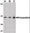 Presenilin 1 antibody, orb87346, Biorbyt, Western Blot image 