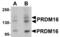 PR domain zinc finger protein 16 antibody, TA306900, Origene, Western Blot image 