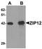 Solute Carrier Family 39 Member 12 antibody, orb75540, Biorbyt, Western Blot image 