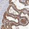 Ribonuclease A Family Member 11 (Inactive) antibody, NBP1-88423, Novus Biologicals, Immunohistochemistry paraffin image 