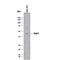 Forkhead Box F1 antibody, AF4798, R&D Systems, Western Blot image 