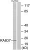 RAB37, Member RAS Oncogene Family antibody, A10452, Boster Biological Technology, Western Blot image 