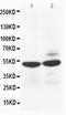 Heparanase antibody, PA1223, Boster Biological Technology, Western Blot image 
