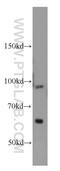 Tuftelin Interacting Protein 11 antibody, 14436-1-AP, Proteintech Group, Western Blot image 