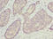 Oligophrenin 1 antibody, orb39777, Biorbyt, Immunohistochemistry paraffin image 